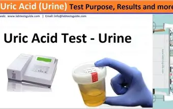 <ol><li><p><strong>Serum uric acid</strong> duh</p></li><li><p><strong>ESR </strong>(inflammation)</p></li><li><p><strong>Urinary uric acid</strong></p></li></ol><p></p><ul><li><p>assess BUN/Cr too</p></li></ul><p></p>