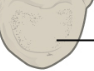 <p>Thick weight-bearing portion</p>