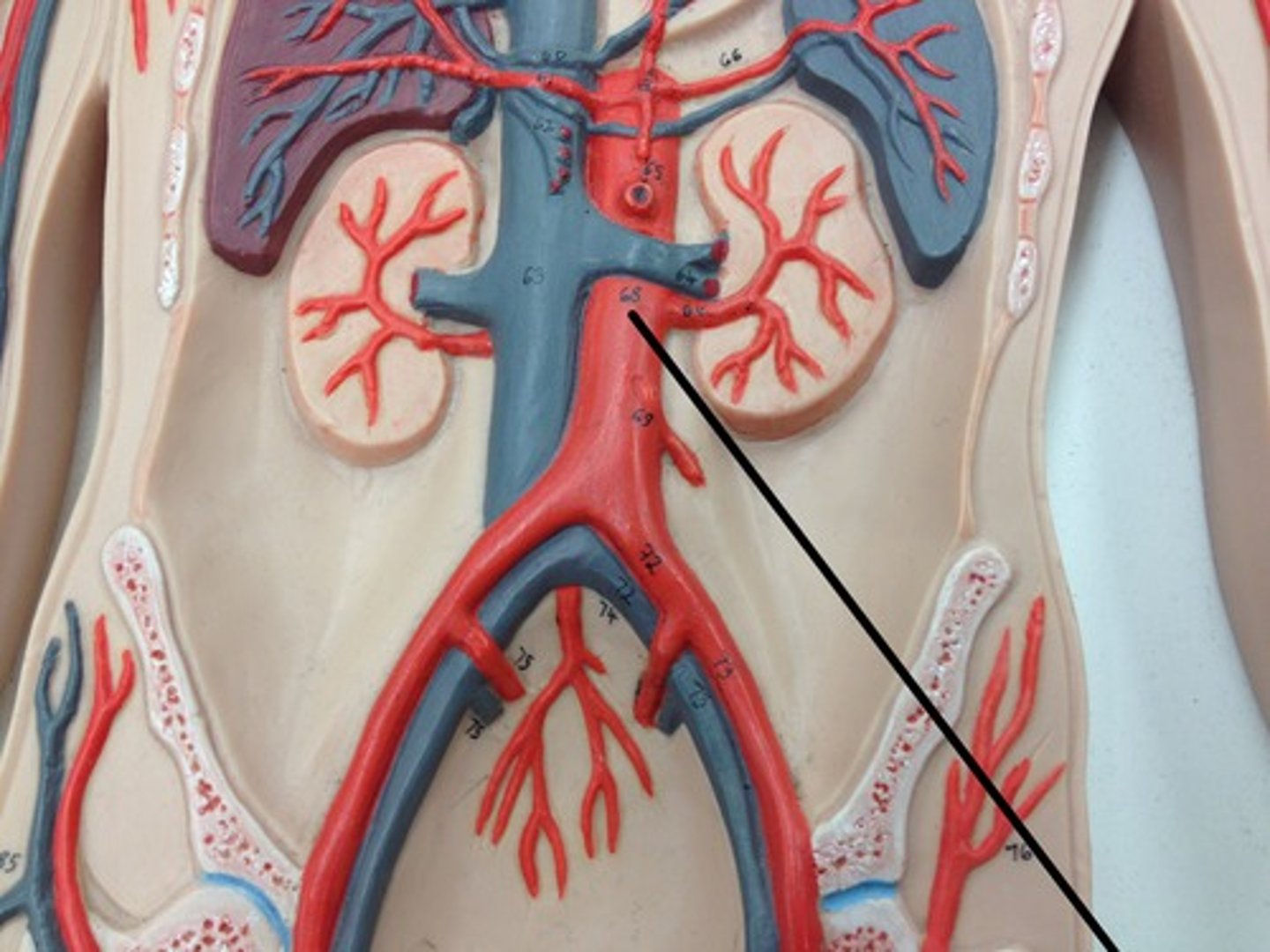 <p>What structure?</p>
