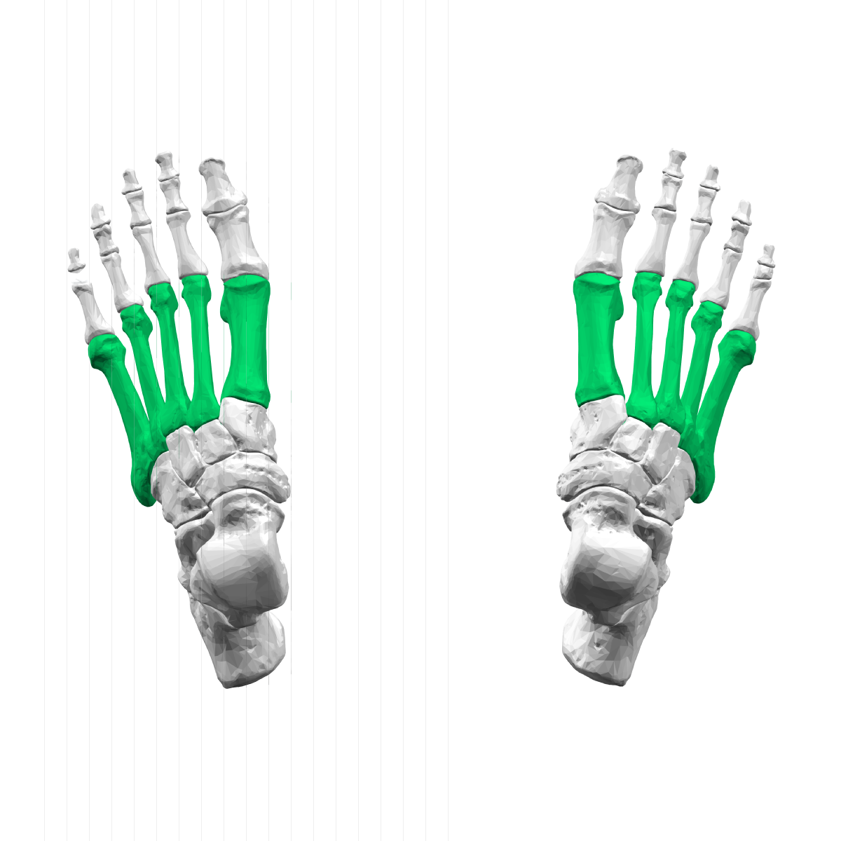 <p>Identify the bone.</p>