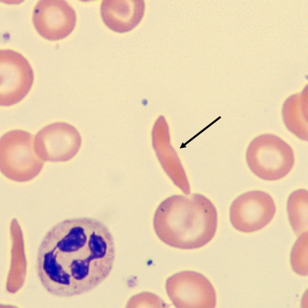 <p>What is the shape of this erythrocyte?</p>