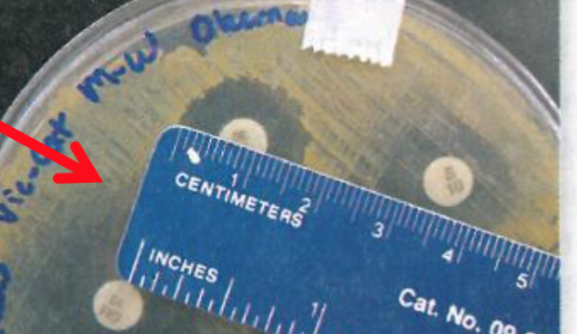 <p>Measurement of circular area around the antibiotic disk</p>