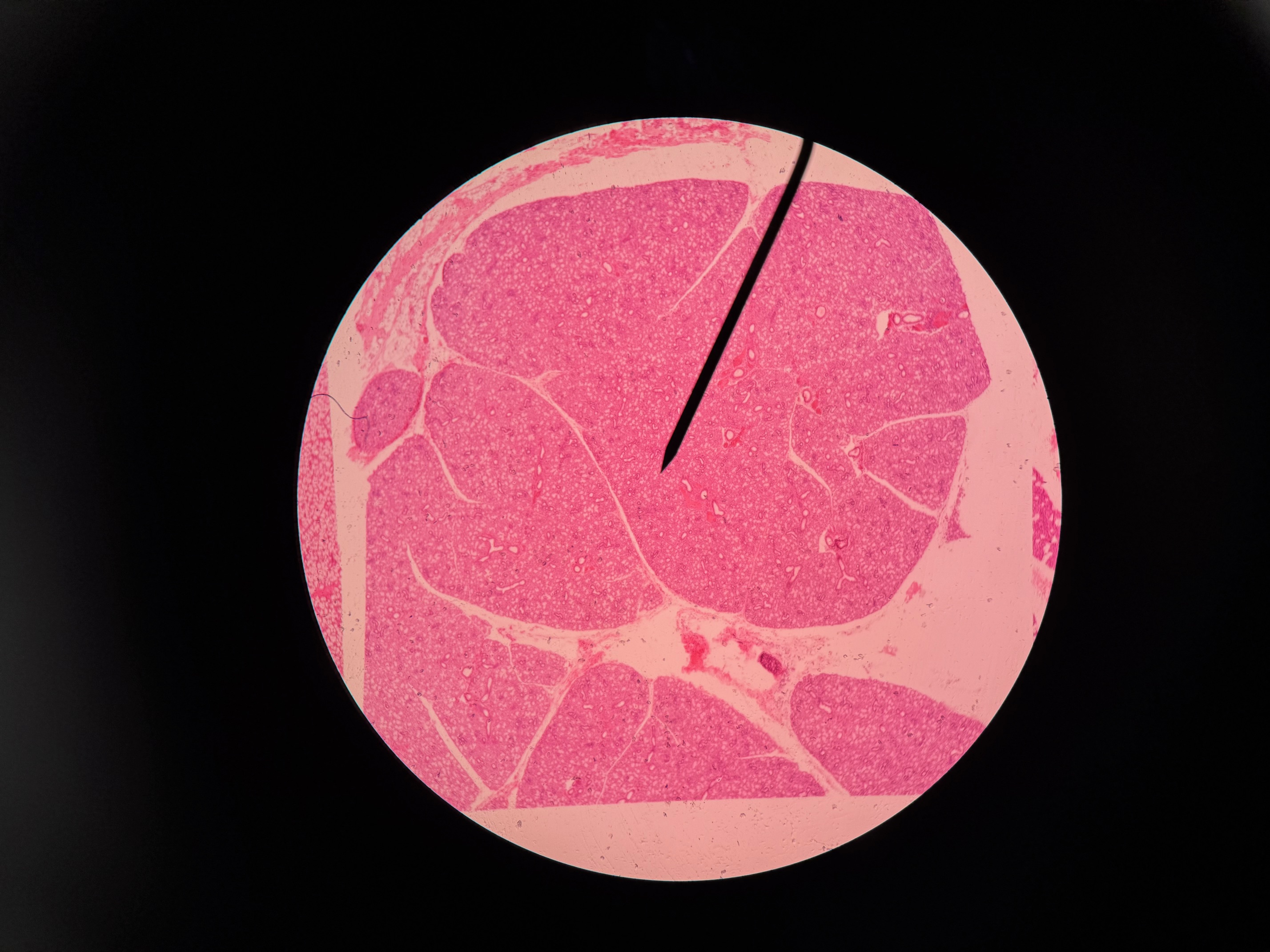 <p>Organ?</p>