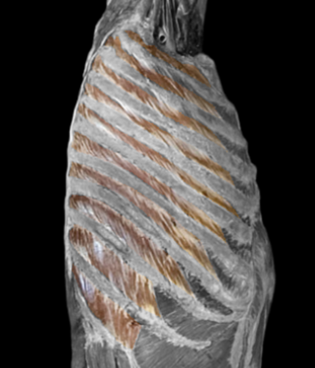 <p>What muscle is this? </p>