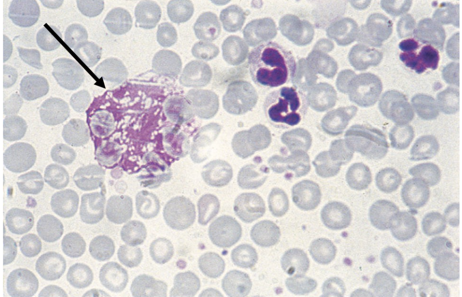The cell immediately below the arrow is a 