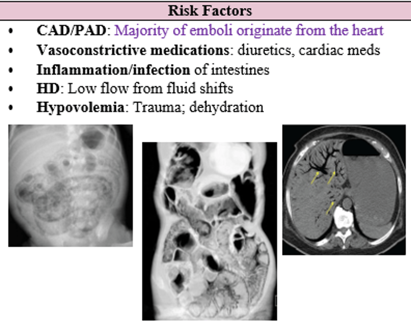 <p>CAD/PAD</p><p>Vasoconstrictive Meds</p><p>Inflammation/Infection</p><p>HD (hemodialysis?)</p><p>Hypovolemia</p>