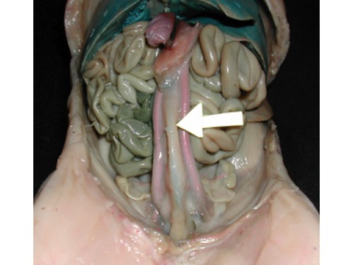 -The bladder connected to the urethra