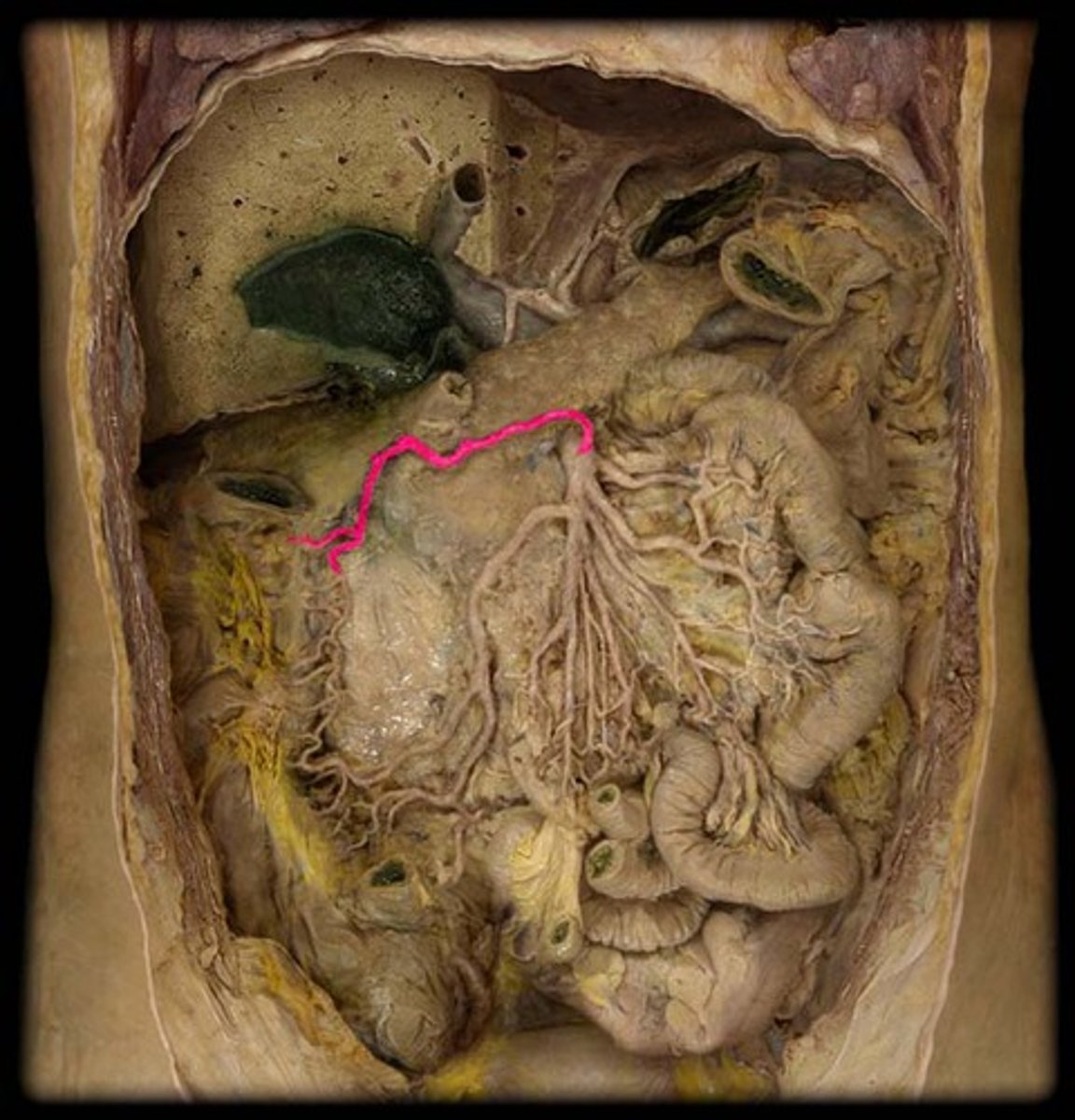 <p> A branch of the superior mesenteric artery that supplies blood to the <strong>transverse colon</strong></p>