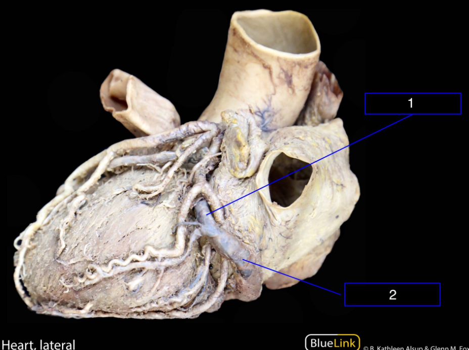 <p>What structures are shown in this video?</p>