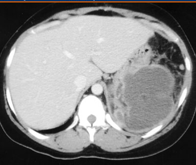 <p>CT scan w/ GI (PO)</p>