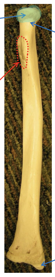 <p>Name the highlighted region</p>