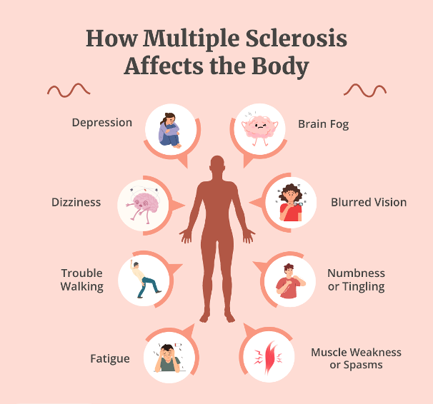 <p>A chronic neurological conditions affecting the brain and spinal core. </p><p>Common responses to the diagnosis</p><ul><li><p>Anger</p></li><li><p class="MsoNormal">Anxiety</p></li><li><p class="MsoNormal">Frustration</p></li><li><p class="MsoNormal">Helplessness</p></li><li><p class="MsoNormal">Hopelessness</p></li><li><p class="MsoNormal">Irritability</p></li><li><p class="MsoNormal">Physical impacts</p></li><li><p class="MsoNormal">Resentments/envy</p></li><li><p class="MsoNormal">Sadness</p></li><li><p class="MsoNormal">Stress</p></li></ul><p></p>