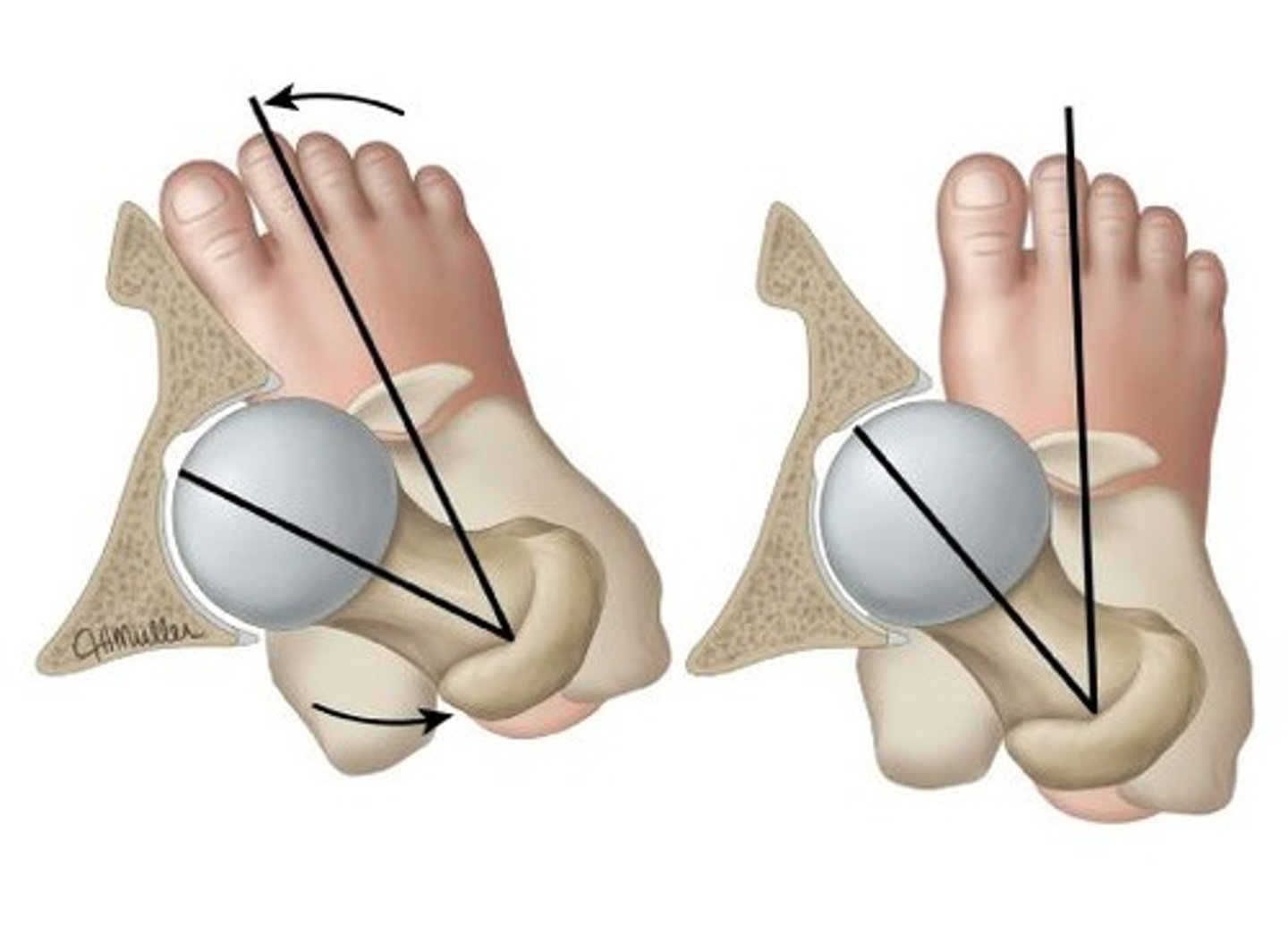 <p>Toe-in compensatory change may result in ___________ torsion of tibia and _______________ of the foot/ankle.</p>