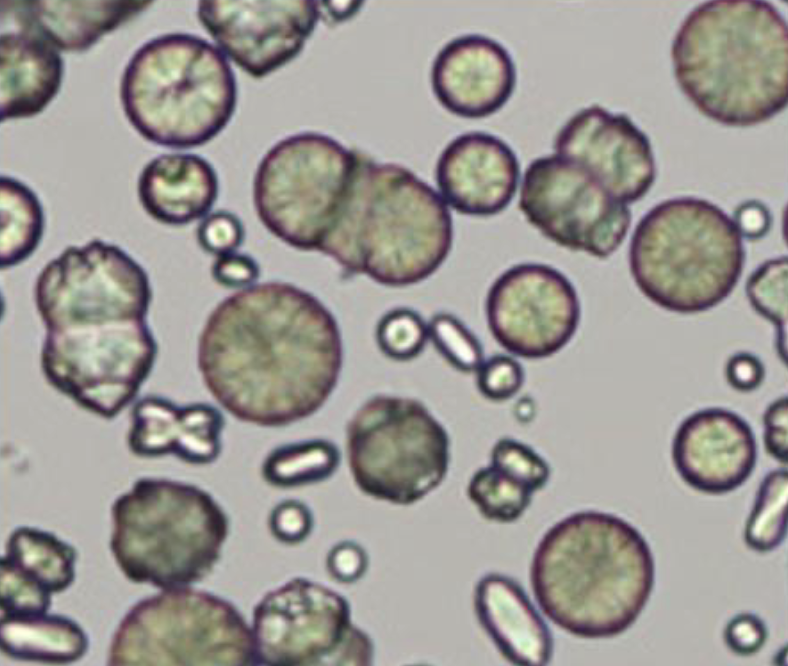 <p>What is this crystal called?</p><p>What animals are these crystals normal in?</p><p>In what animals are they not seen?</p><p>Are they acidic or alkaline?</p>