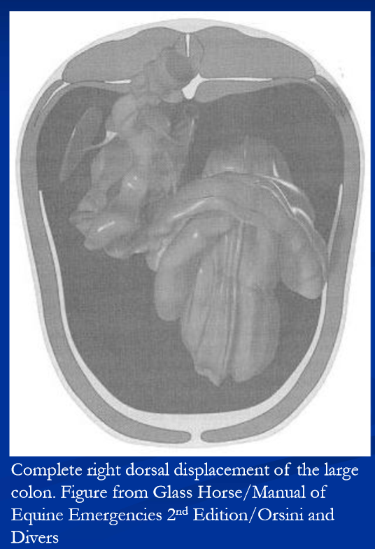 <p>Right dorsal displacement of the large colon </p>