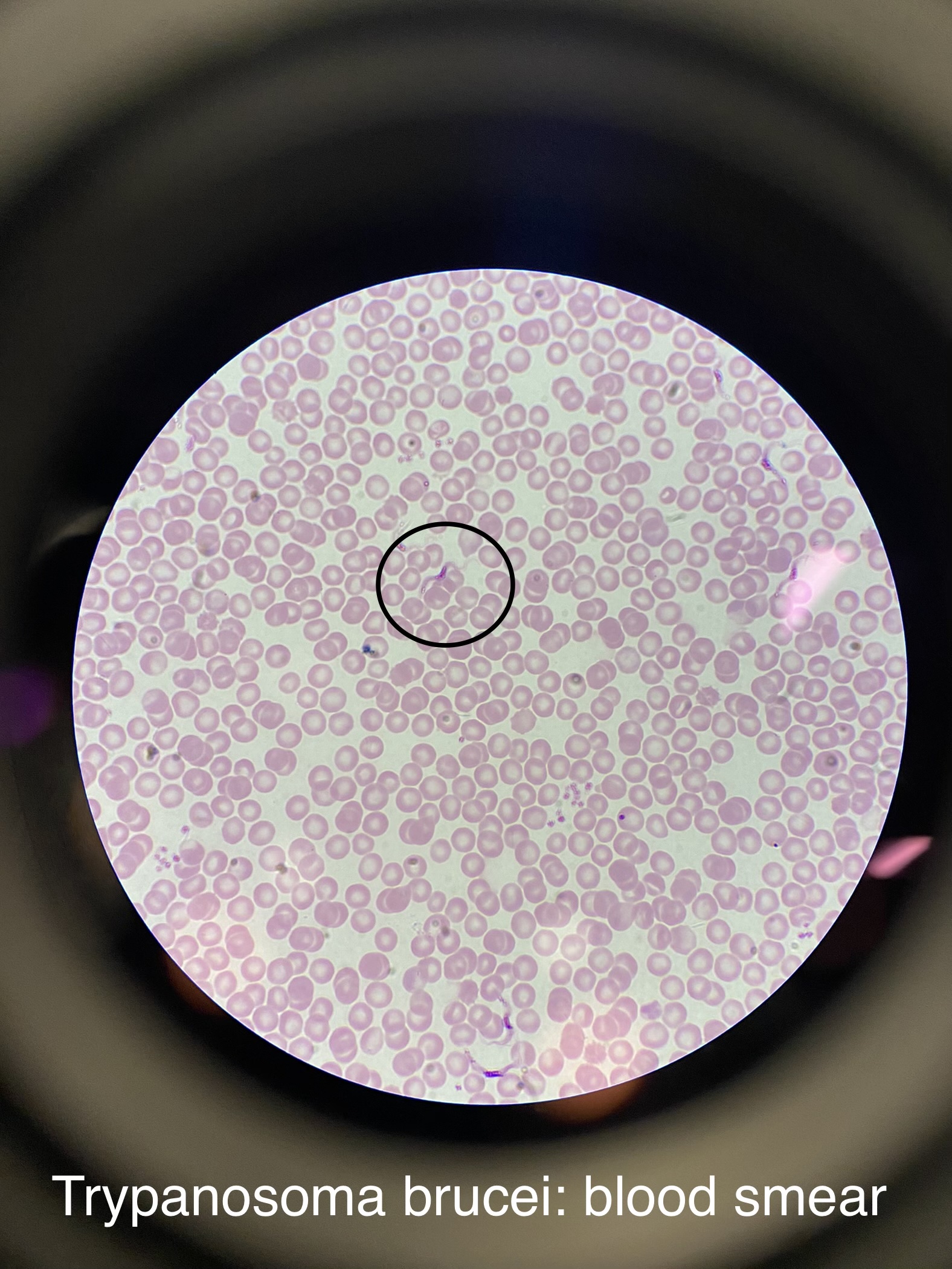 <ul><li><p>two subspecies</p></li><li><p>(Gambiense 1st pic and Rhodesiense 2nd pic )</p></li><li><p>causes sleeping sickness disease</p></li><li><p>found in Africa</p></li><li><p>transmitted by Glossina Flies</p></li></ul>