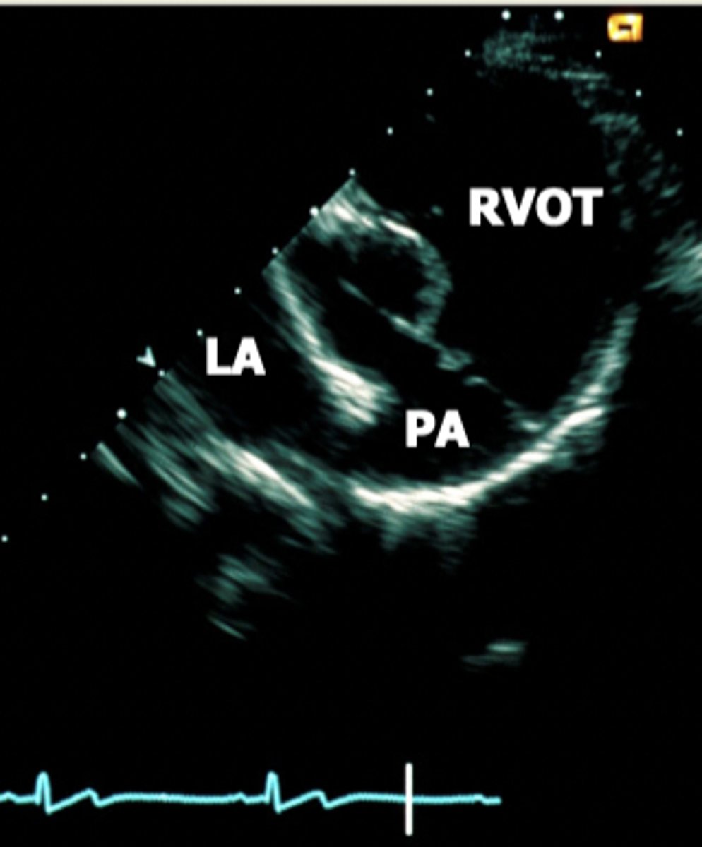 <p>mercedes benz logo</p>