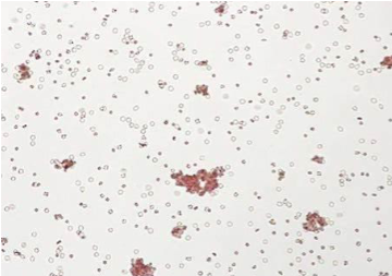 <p><span><span>to determine the amount of RhIg needed to prevent the mother from forming an immune response due to the hemorrhage</span></span></p>