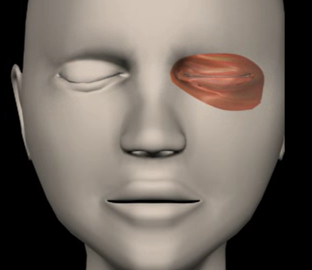 <p>Function: closes eye, squint</p><p>Origin: frontal &amp; maxillary bones</p><p>Insertion: tissue of eyelid</p>