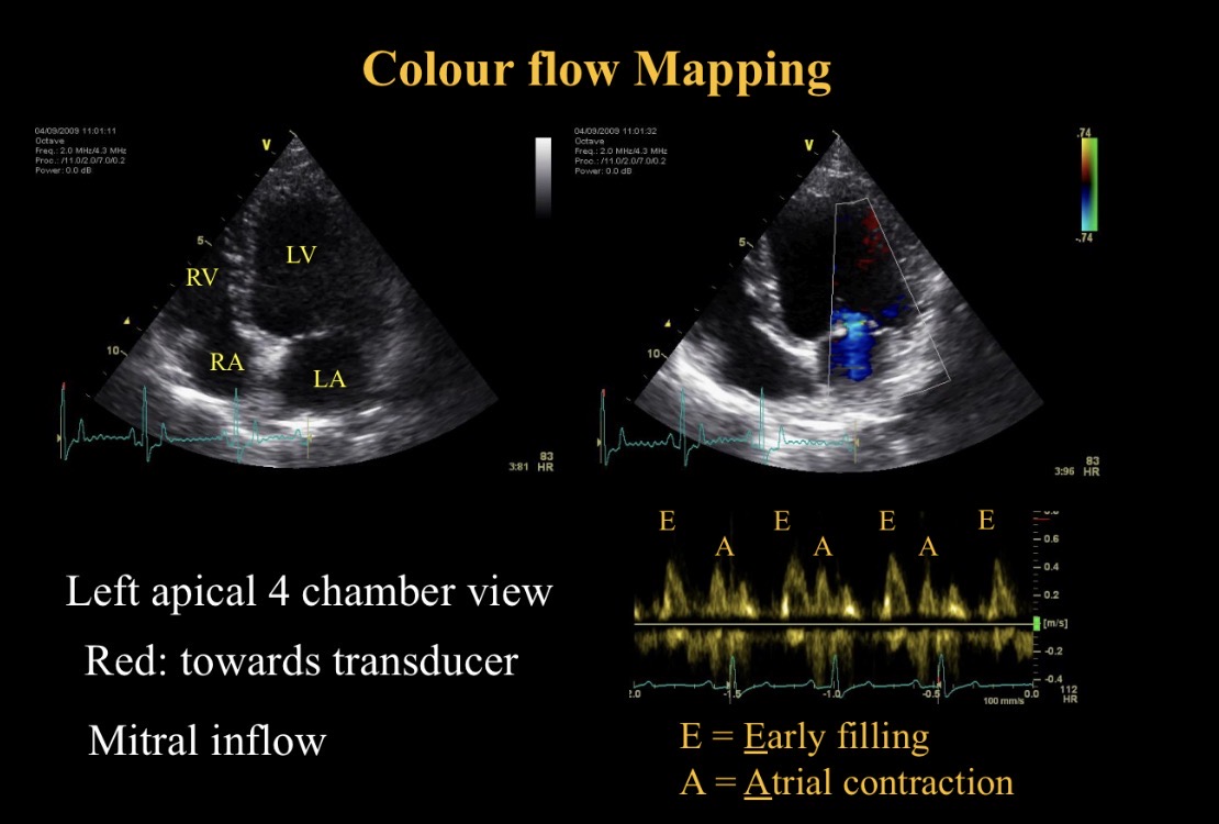 <p>A peak meaning </p>