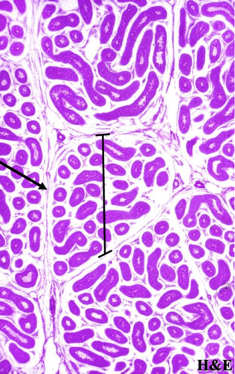 <p>What is the arrow pointing to?</p>