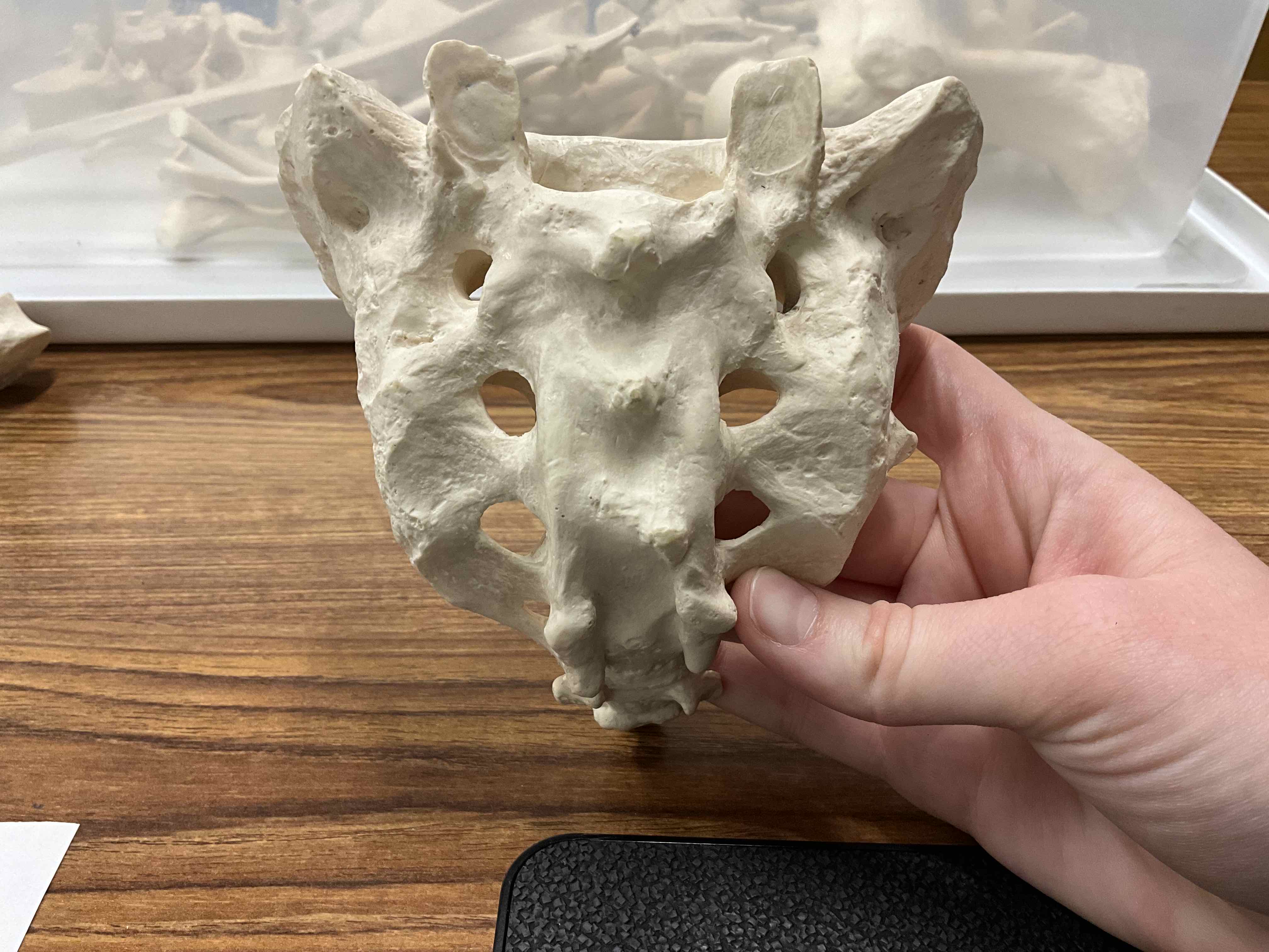 <p>Name this bone</p>