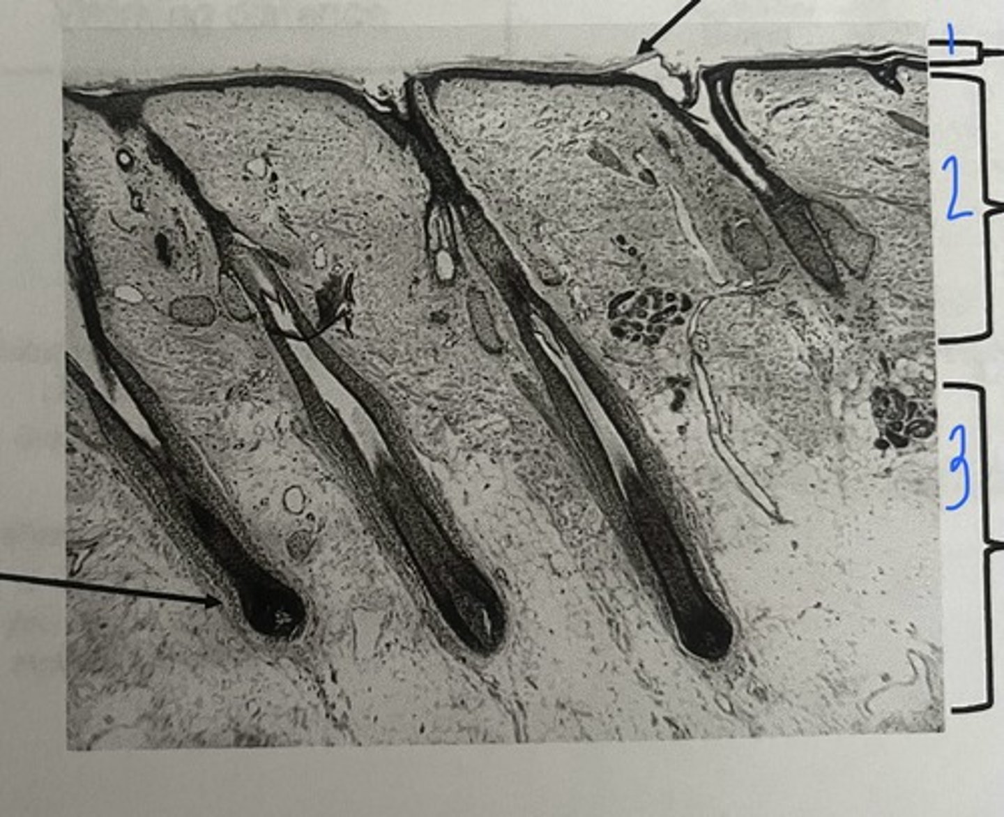 <p>According to under the microscope, what is #2?</p>
