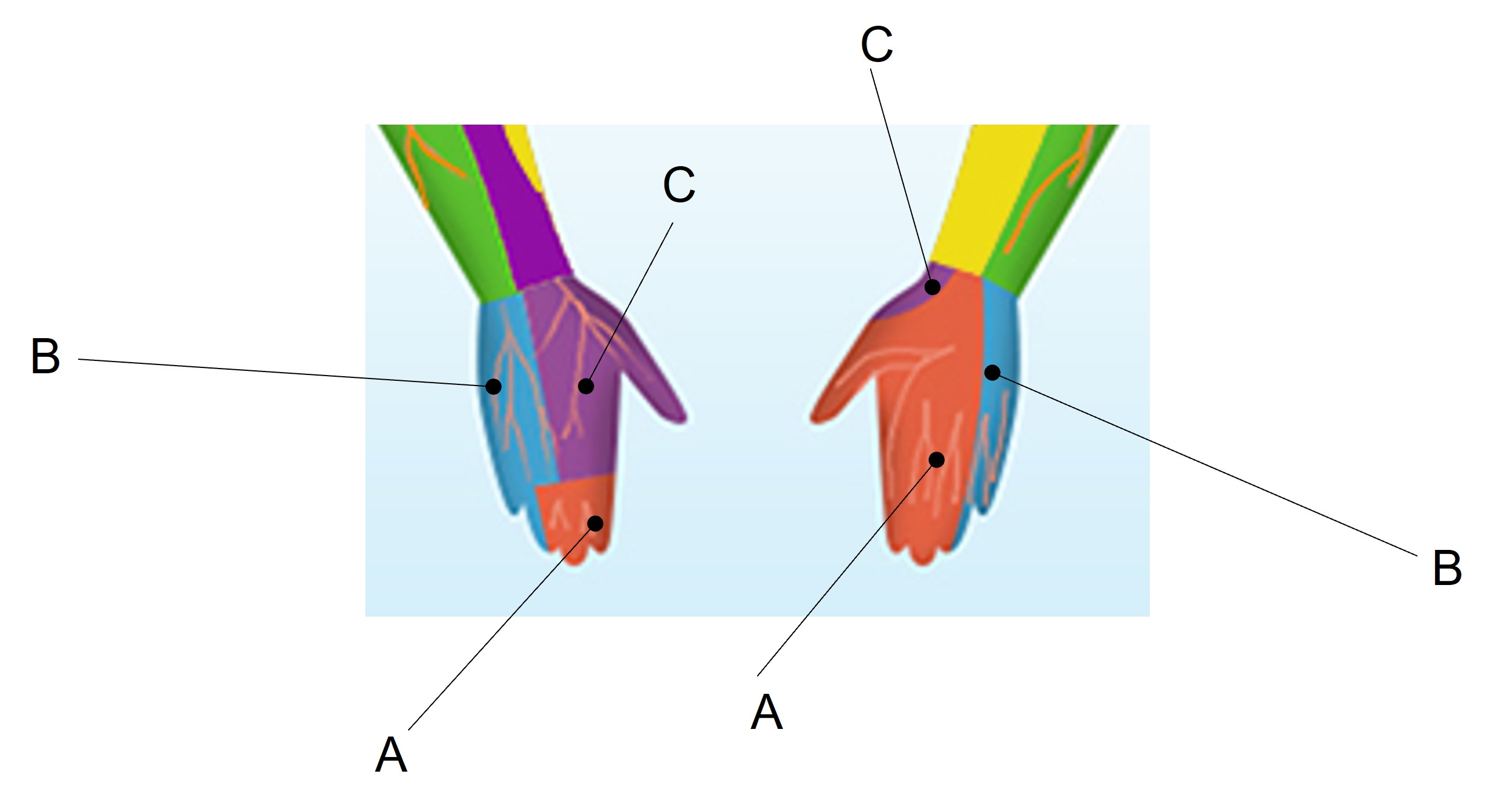 <p>Match the appropriate term with the landmark or structure identified in the picture below. Answers are used once and there are incorrect choices.</p><p>What is B?</p><p>A) Ulnar nerve<br>B) Radial nerve<br>C) Median nerve</p>