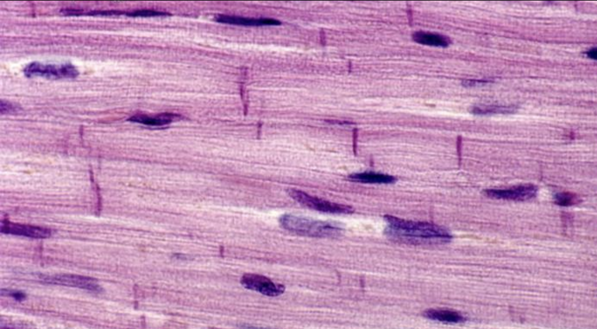 <p>Characteristics of cardiac muscle  (location, function, control mode, shape, junctions, structure)</p>