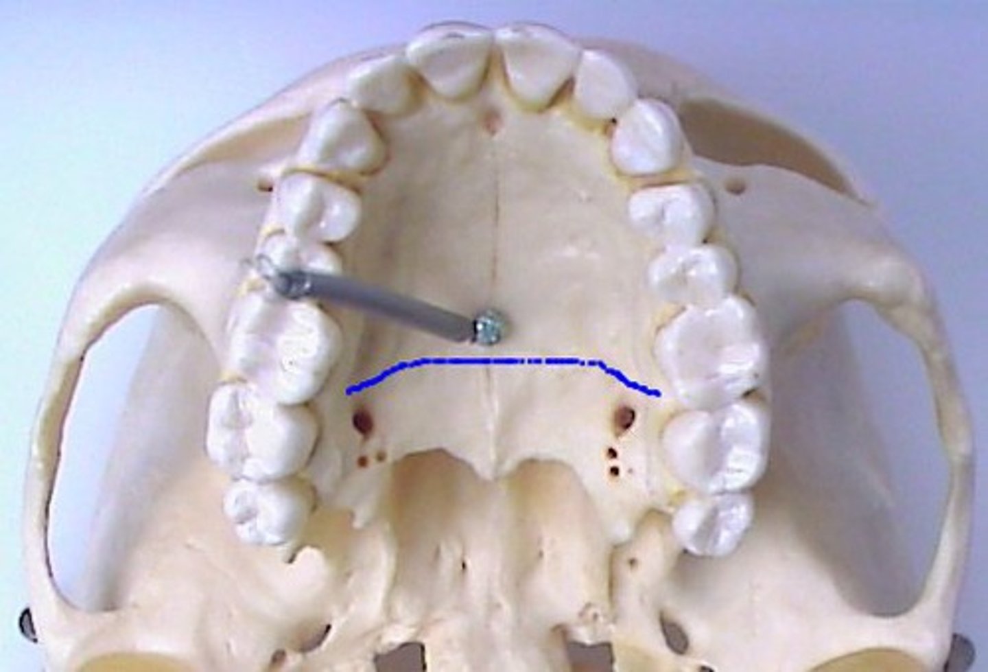 <p><em>identify the structure:</em></p>