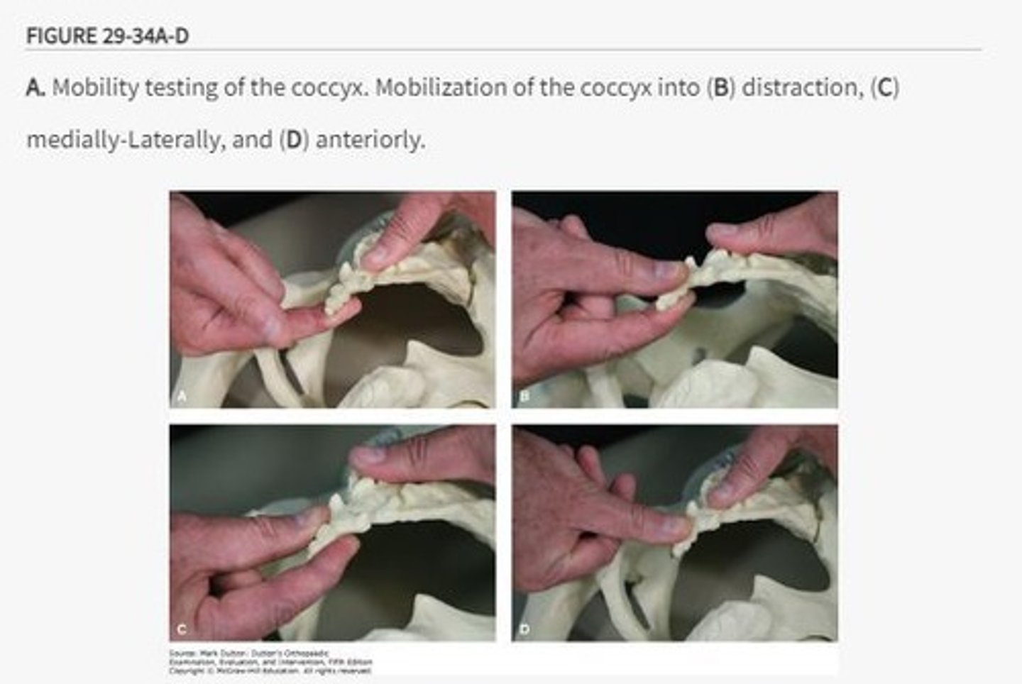 <p>The coccyx can be distracted or mobilized in various directions to improve mobility.</p>