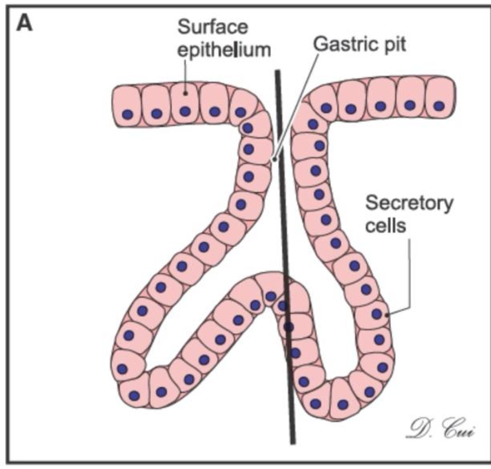 <p>What kind of gland is this?</p>