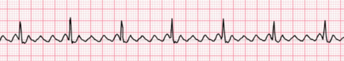 <p>Name the rhythm</p>