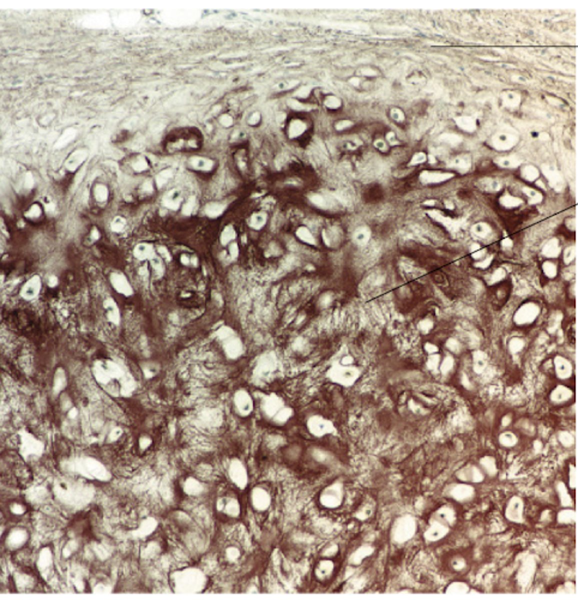 <p>Identify the cartilge</p>