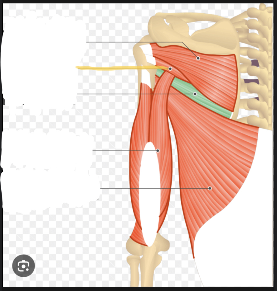 <p>Identify the highlighted muscle</p>