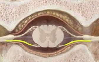 <p>what is the yellow color indicating in the spinal cord cross section</p>