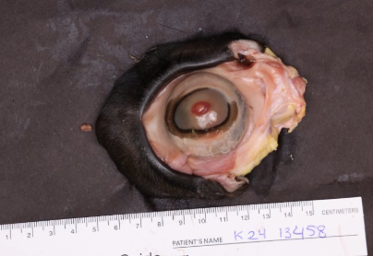 <p>Describe the distribution of this lesion.</p>