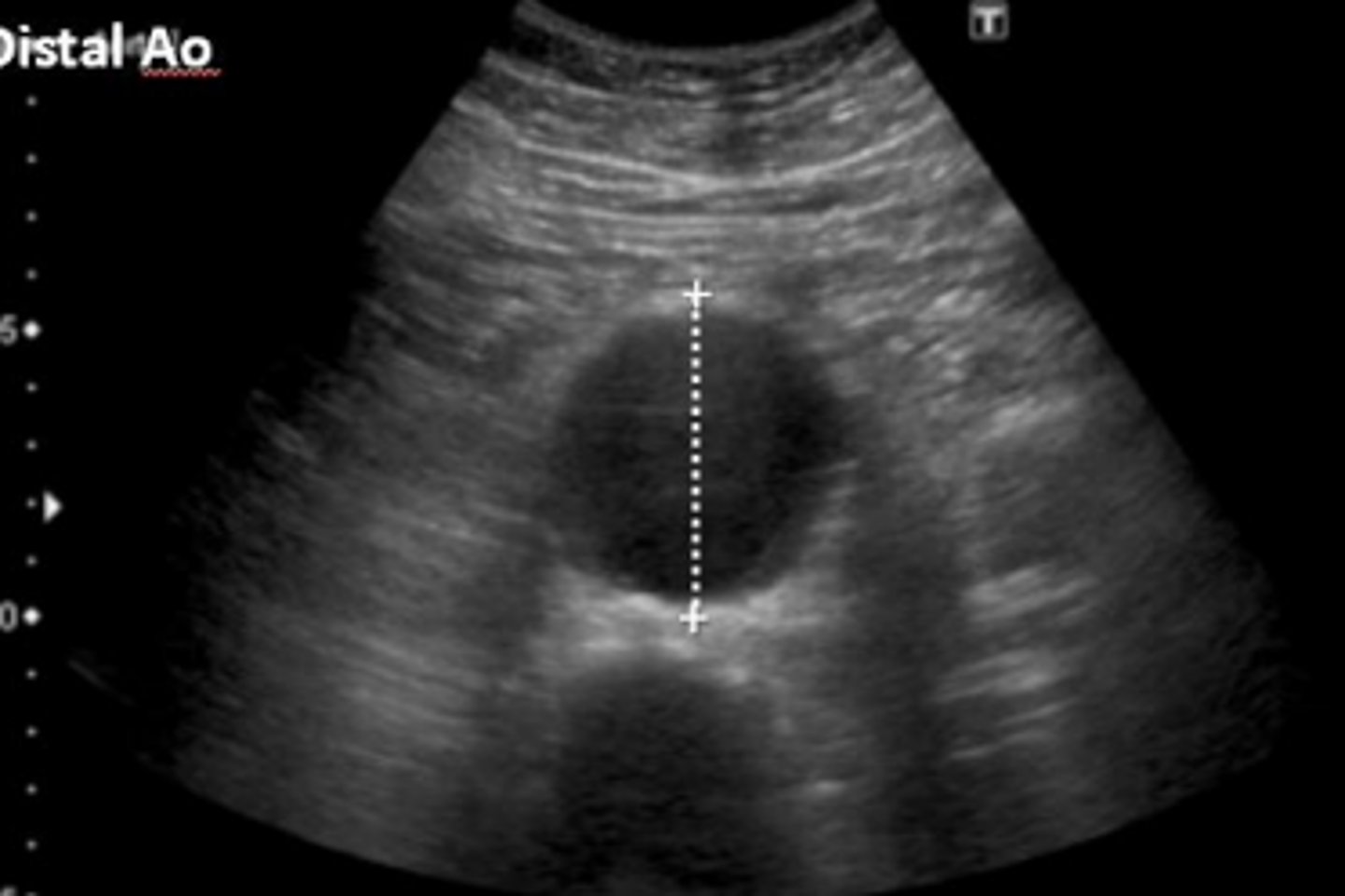 <p>What is seen here?</p>