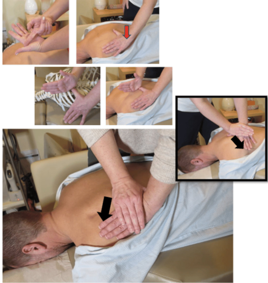 <p>• PP: Prone, permission to open gown/contact, identify finding segment</p><p>• DP: Stand on opposite side of contact, facing cephalad for I-S or caudal for S-I vector, tissue drawn from spine out to rib (M-L)</p><p>• CH: Caudal thumb-thenar contact follows the rib angle lateral to the transverse process</p><p>• IH: Cephalad pisiform-hypothenar contact reinforces over thumbnail with fingers wrapped around the wrist</p><p>• LOD: P-A and I-S</p><p>*OR P-A and S-I, depending on intended vector</p><p>*R3-R12</p>