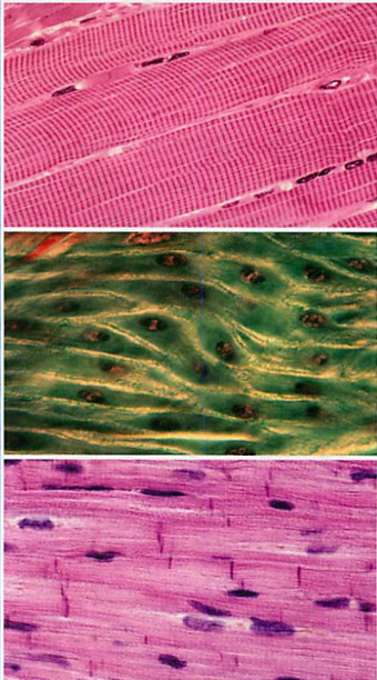 <p>Function: allows movement, designed to change shape, act by shortening and lengthening</p><p></p><p>Skeletal muscle: cells that line up in the same direction(makes tissue look striped), attaches to bone so the body can move, found in places where body needs support(limbs: arms, legs).</p><p>Smooth muscle: cells that are tapered at both ends(don’t look striped), contracts more slowly than skeletal muscle but its action is sustained for a long time, found in blood vessels and walls of internal organs(esophagus, stomach).</p><p>Cardiac muscle: cells w/nuclei that appear to be between cells, branched/unevenly striped, contracts as a unit, found in the heart.</p>