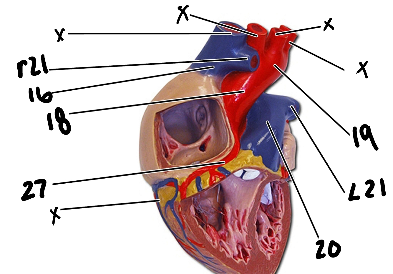 <p>L21</p>