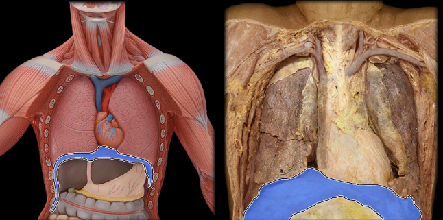 <ul><li><p>Action: Dome of diaphragm flattens during inspiration, Contraction increases vertical dimension of thoracic cavity</p></li><li><p>Origin: Sternal part (not always present): xiphoid process, Costal part: ribs 5-10 and their costal cartilage, Lumbar part: arcuate ligaments and L1-3 vertebral bodies</p></li><li><p>Insertion: Central tendon</p></li><li><p>Innervation: Phrenic nerve</p></li></ul><p></p>