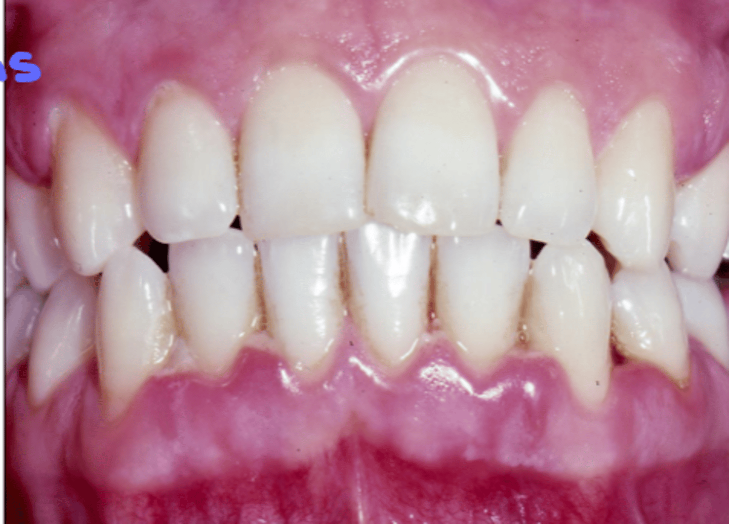 <p>True, but with relatively few local factors</p>