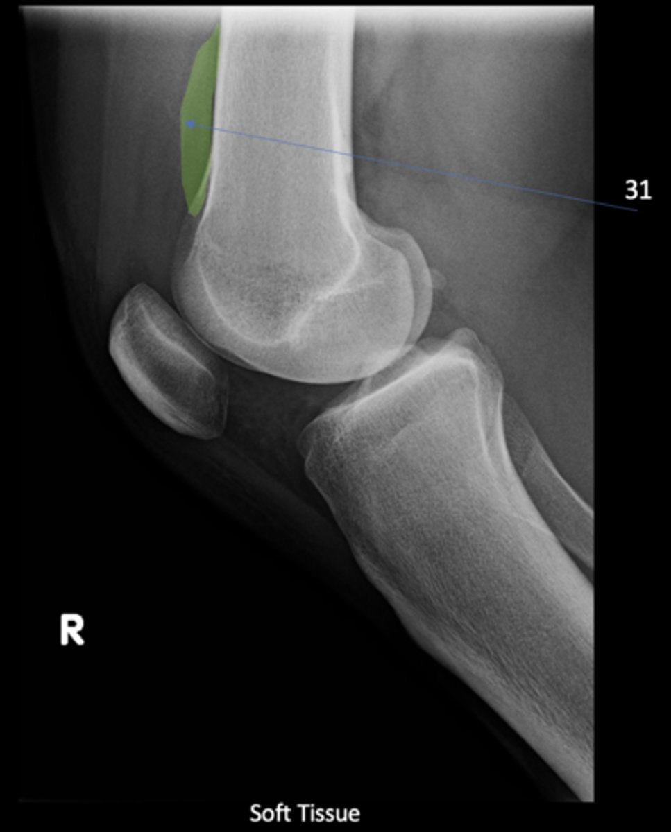 <p>ID 31</p>