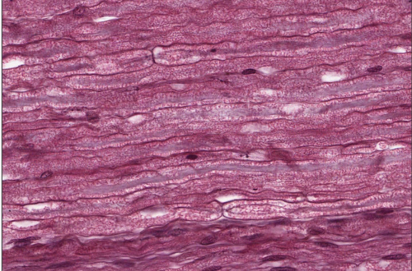 <p>space between axons</p>