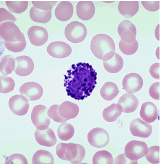 <p>What is the primary function of the leukocyte pictured?</p><p><br>A. Destroying cancerous or infected cells</p><p>B. Releases of histamine to start inflammation</p><p>C. Phagocytosis of foreign material</p><p>D. Turning off inflammation</p><p>E. Producing antibodies</p>