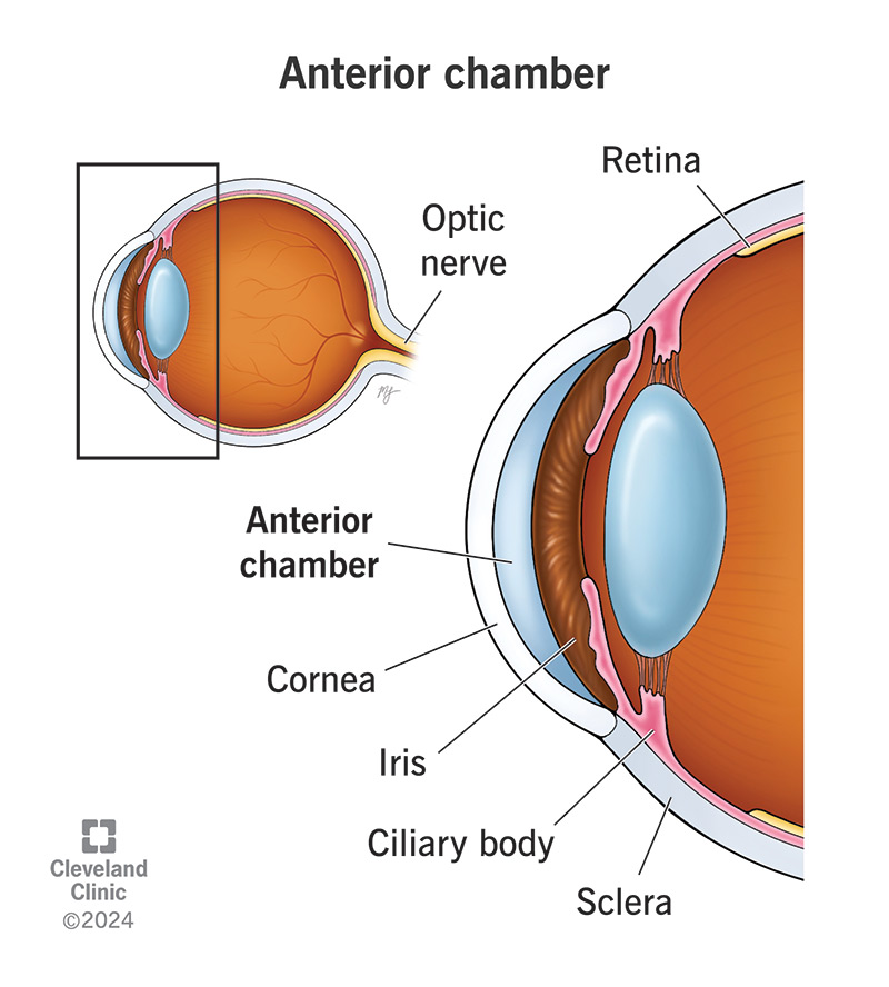 <p>Anterior chamber</p>