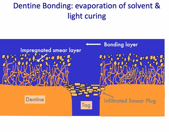 <p>dentine bonding - evaporation of solvent in the bonding and light curing </p>
