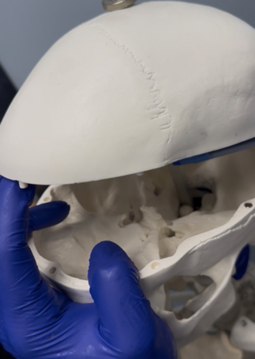 <p>big ahhh bone present is</p>