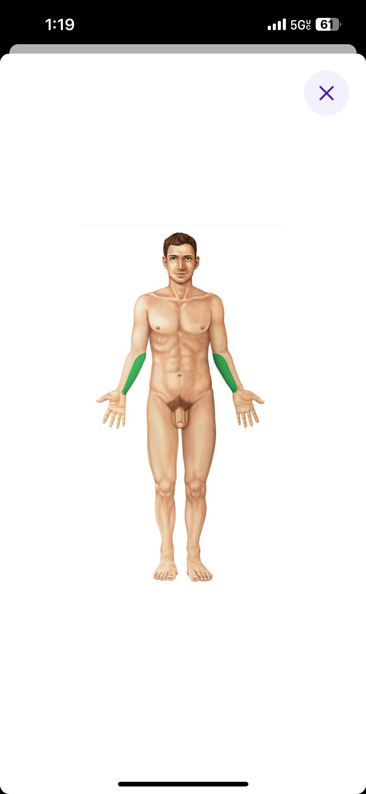 <p>Forearm same side as the pinky</p>
